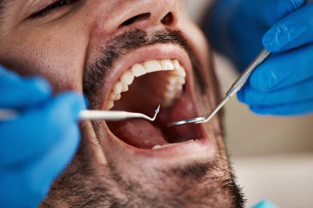 Best Dentist for Tooth Abscess  in West Odessa, TX